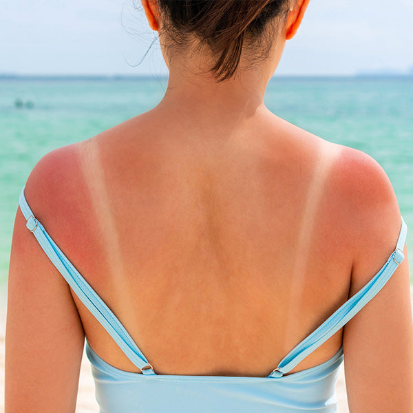 Hautberuhigende After-Sun-Creme